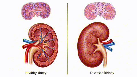 kidney