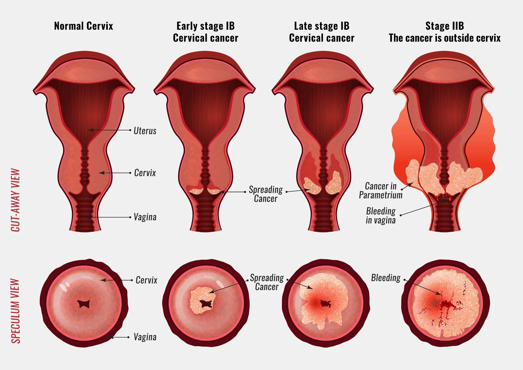cancer servics