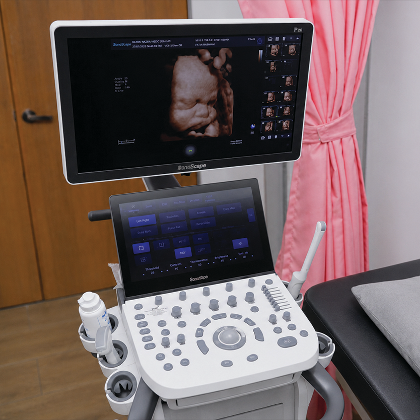 ultrasound ultra sound scan