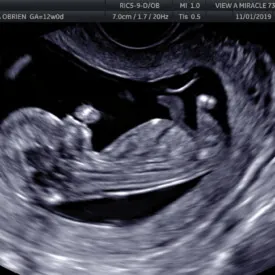 12-week