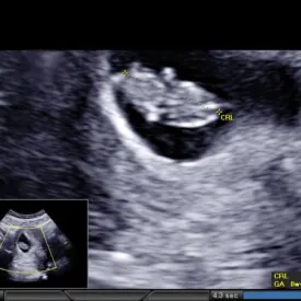 8-weeks