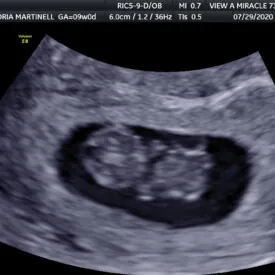 9-week
