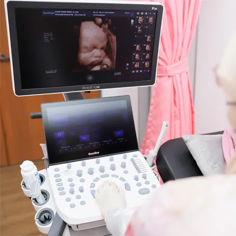ultra sound scan
