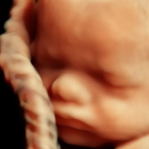 Ultrasound RM115